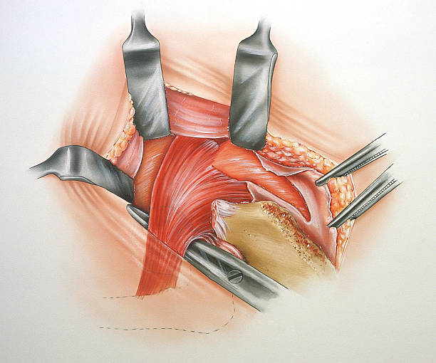 endoscopic dcr