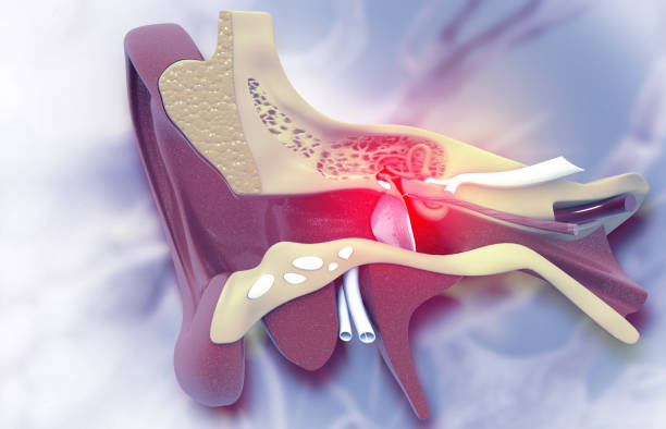 mastoid surgery