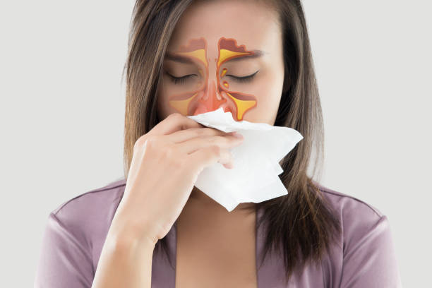 nasal allergy