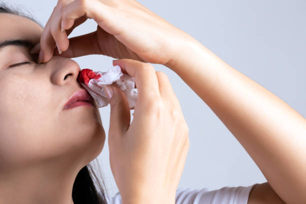 nose bleeding