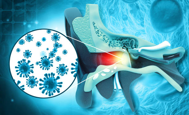 stapedectomy